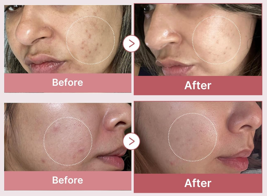 medicube PDRN Pink Peptide Serum