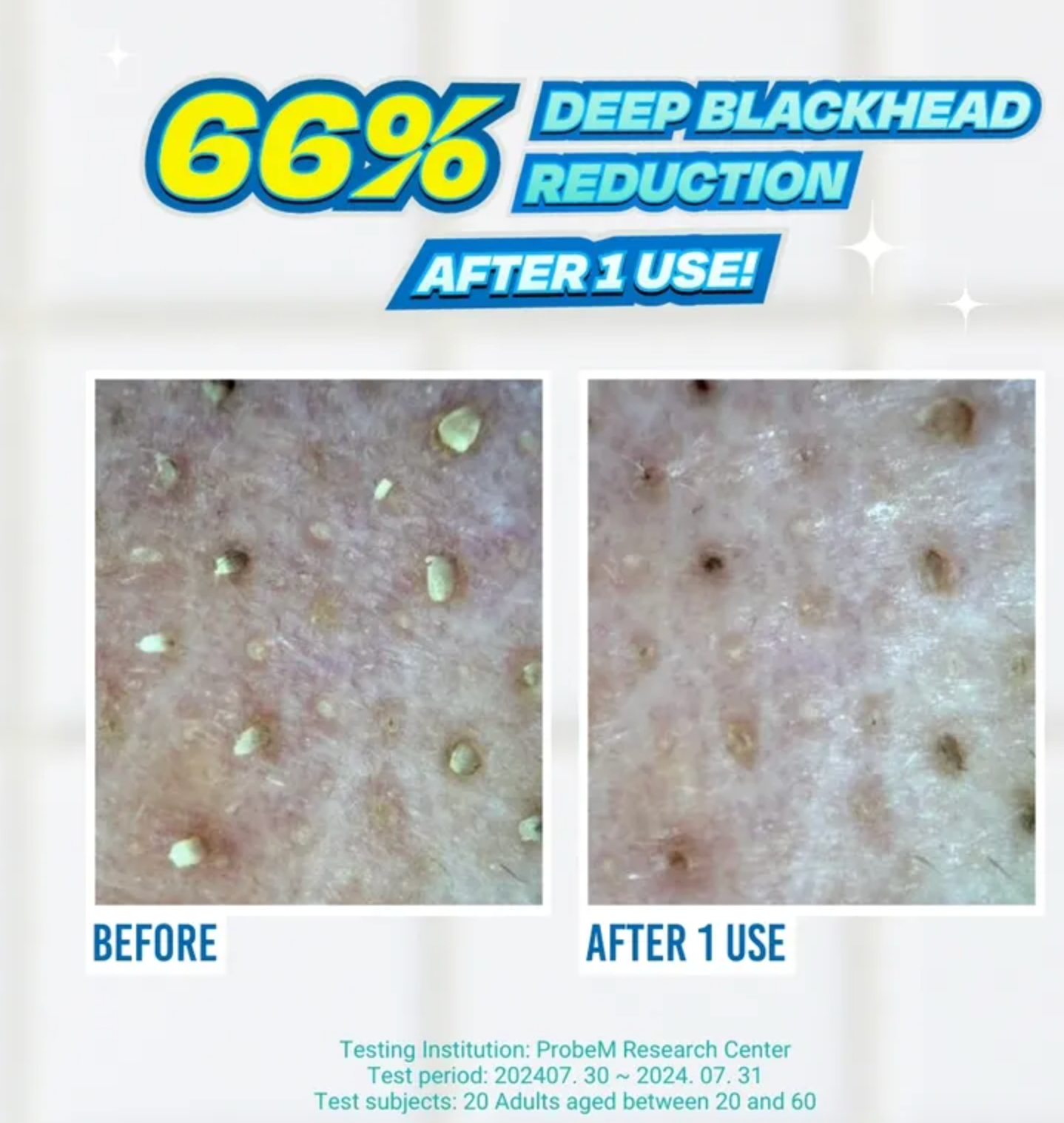 Jumiso Blackhead melting softener 150ml + cotton pad(40pads) set