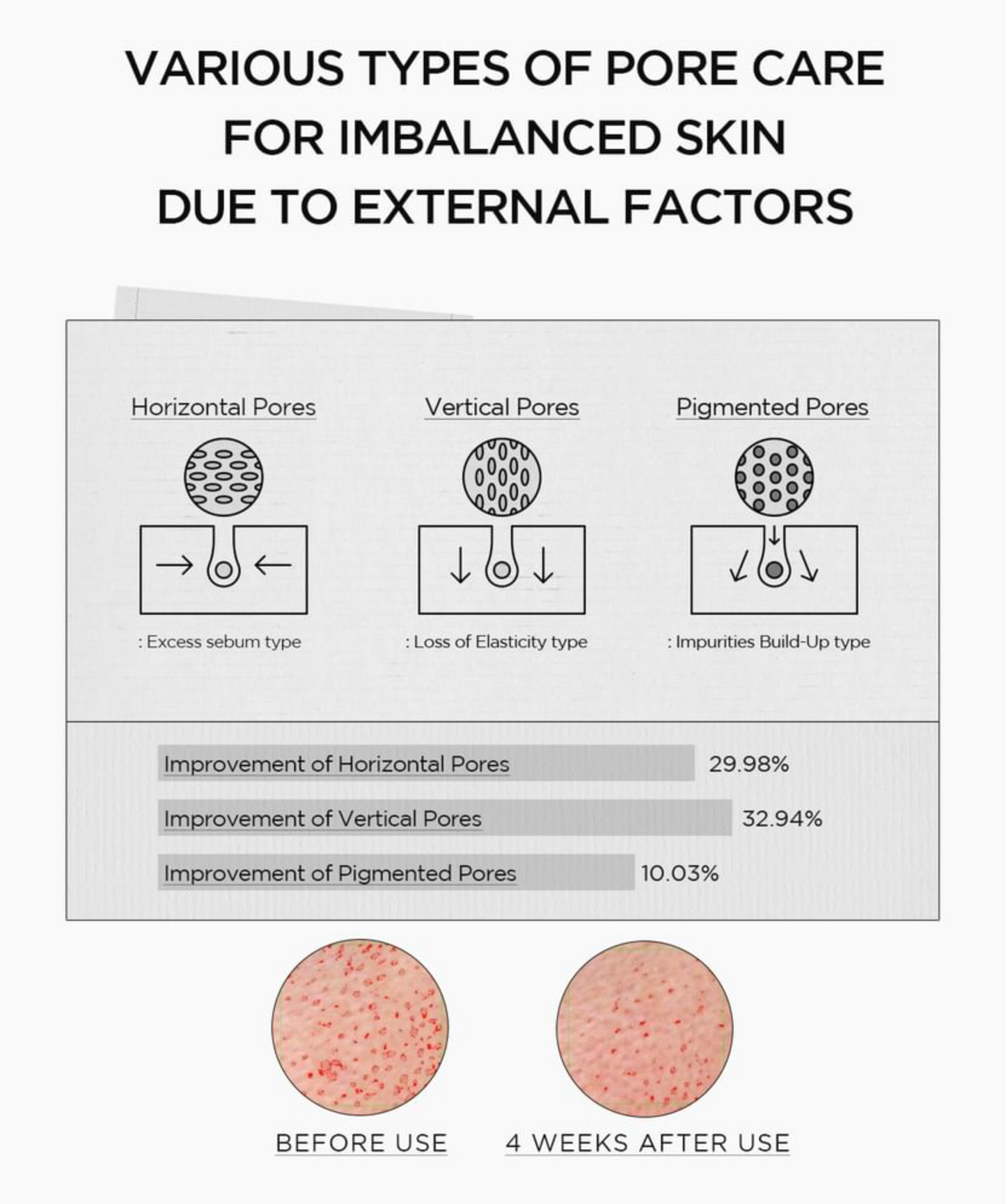 SKIN 1004 Madagascar Centella Niacinamide 10 Boosting Shot Ampoule 30 ml