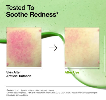 Anua - Azelaic Acid 10 Hyaluron Redness Soothing Serum