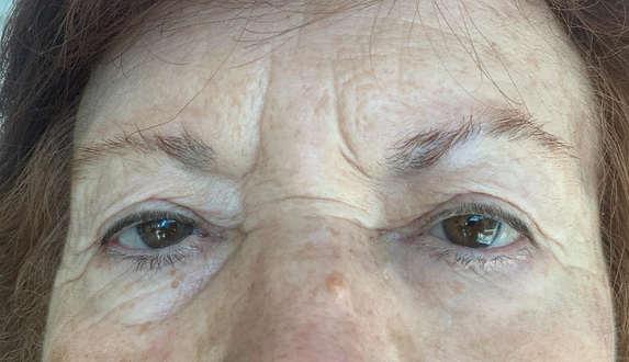 NINELESS Ever-Youth Dual Effect Eye Cream