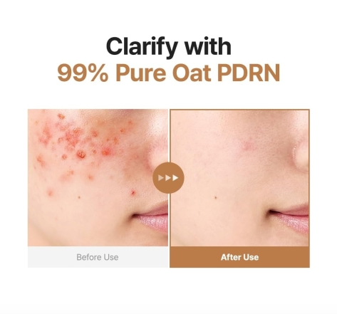 Purito Oat PDRN Gentle Refining Toner 200ml