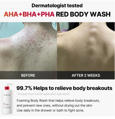 Medicube Red Acne Body Wash 2.0 400g