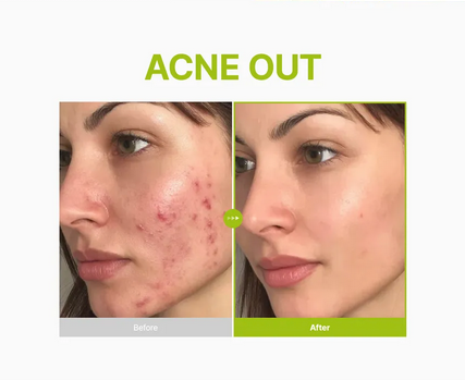 Purito Azelaic Acid 10 Kojic Azulene Serum 30ml