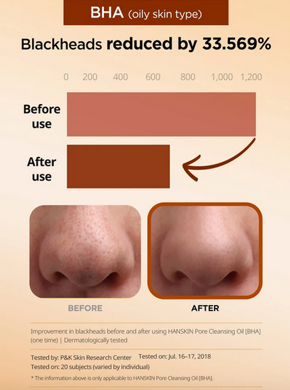 Hanskin Pore Cleansing Oil BHA 300ml