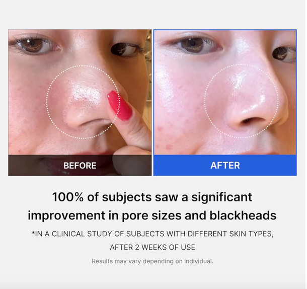 Medicube ZERO PORE PAD MILD (70pcs)