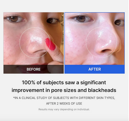 Medicube ZERO PORE PAD MILD (70pcs)