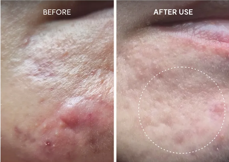 Arencia Eraser Shot Glycolic Acid Booster 30ml