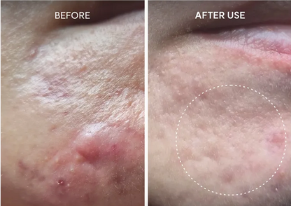 Arencia Eraser Shot Glycolic Acid Booster 30ml