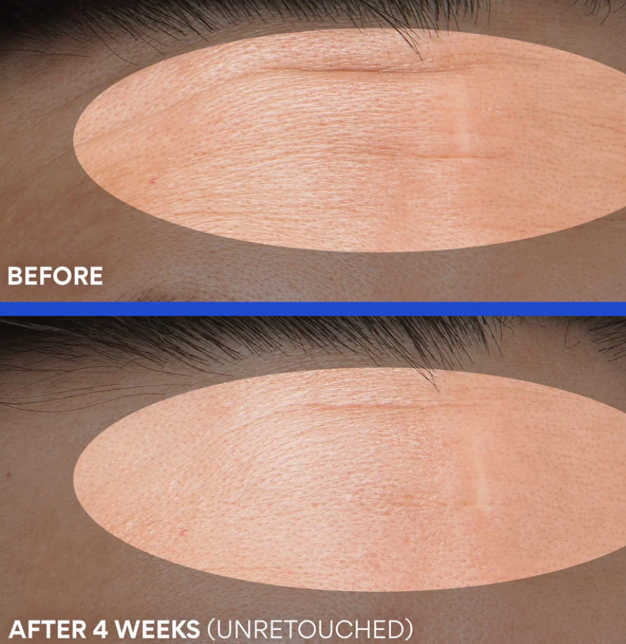 innisfree Retinol Green Tea PDRN Skin Booster Ampoule 25ml