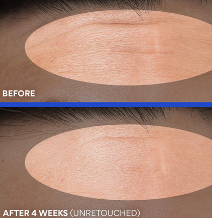 innisfree Retinol Green Tea PDRN Skin Booster Ampoule 25ml