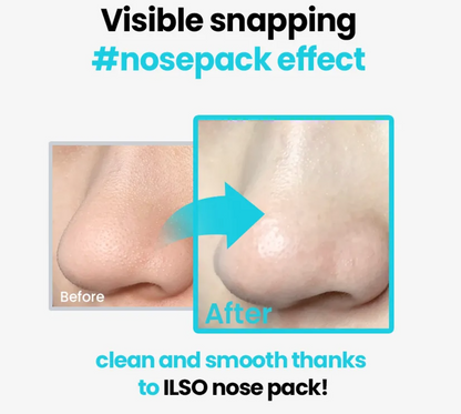 ilso - Natural Mild Clear Nose Pack