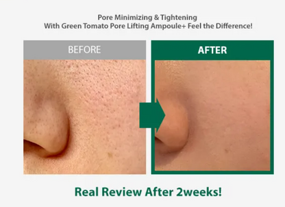 SUNGBOON EDITOR Green Tomato Pore Lifting Ampoule+
