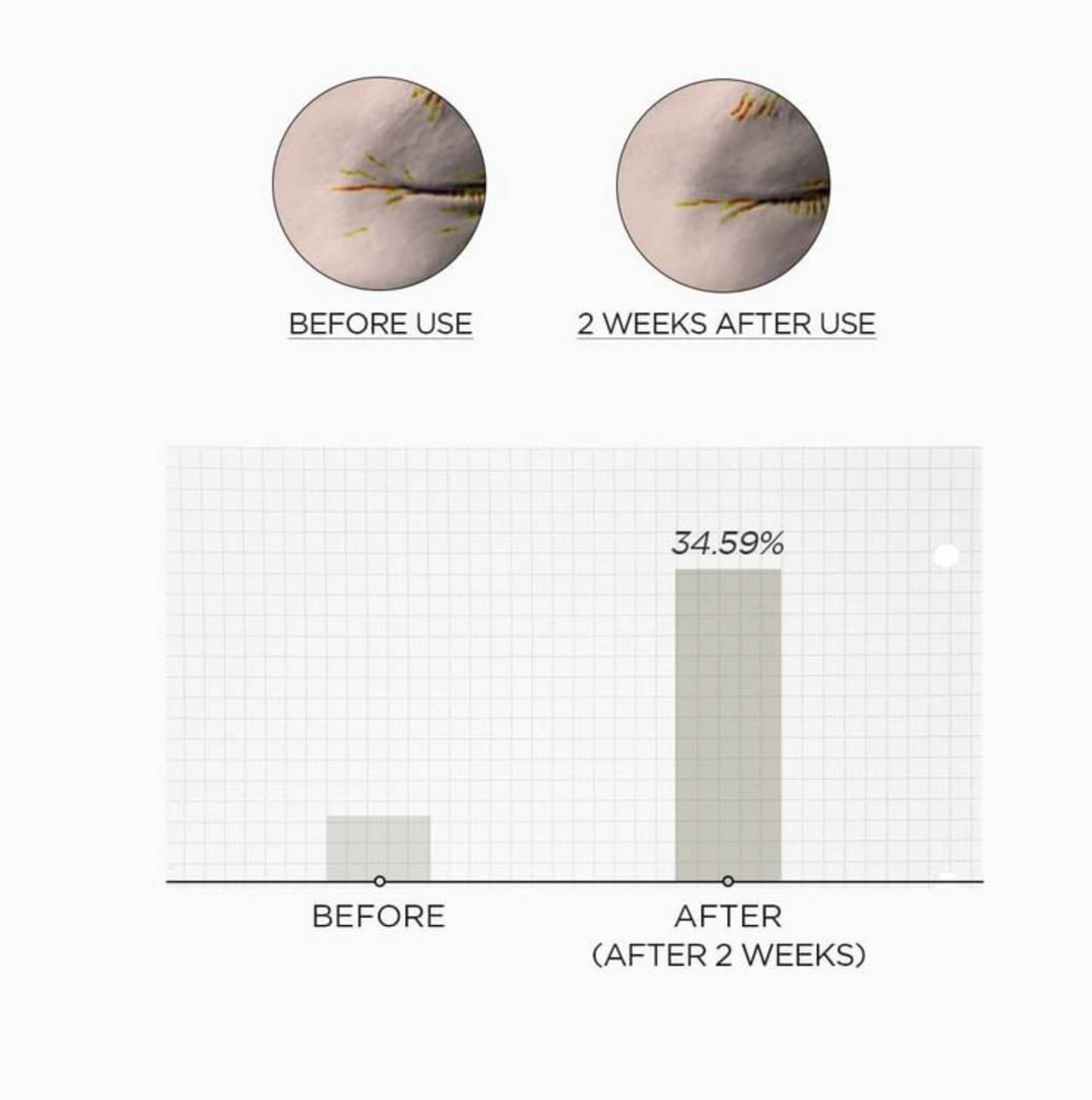 SKIN 1004 Madagascar Centella Retinol 0.2 Boosting Shot Ampoule