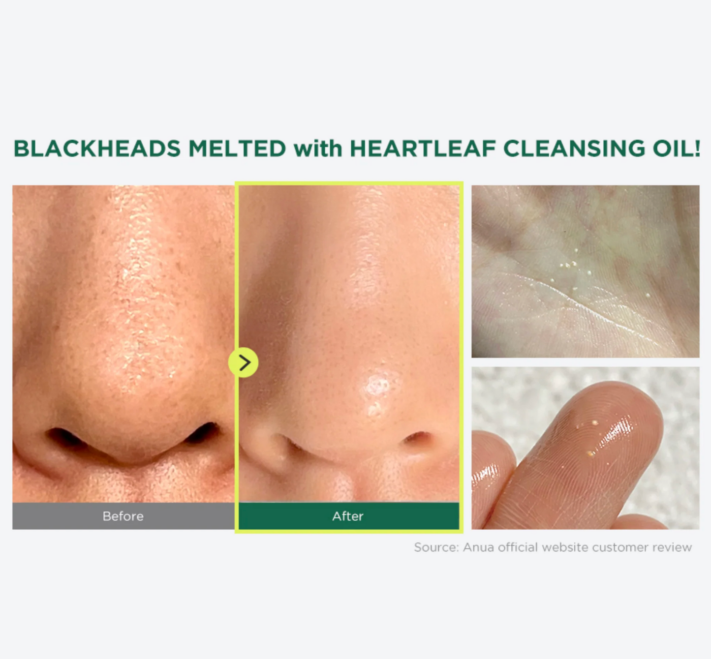 Anua Heartleaf Pore Control Cleansing Oil - Desmaquillante Limpiador a Base de Aceite